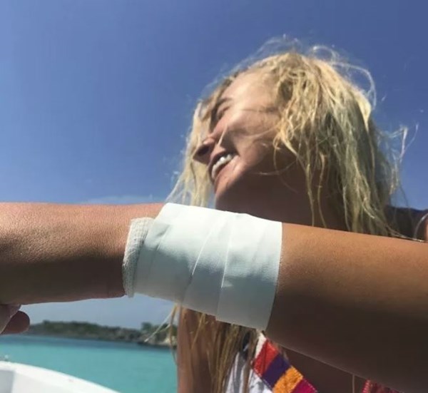 Manekenku napao morski pas dok je pozirala s njima za Instagram